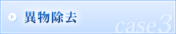 異物除去