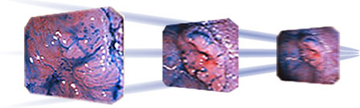 微細な病変をとらえる拡大技術