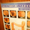 大腸内視鏡
